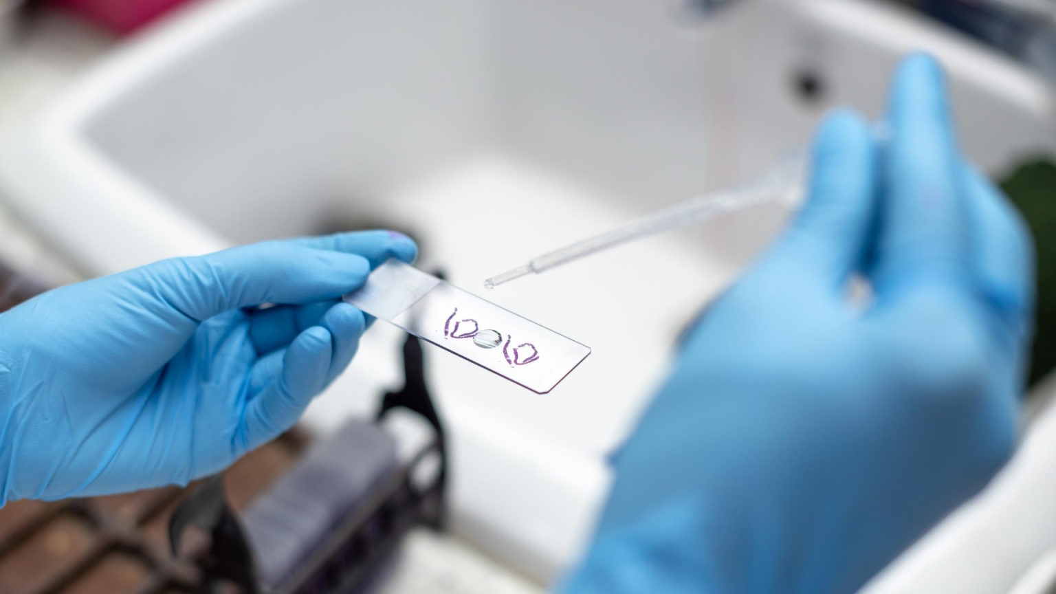 What Is a Biopsy? Walnut Hill OBGYN